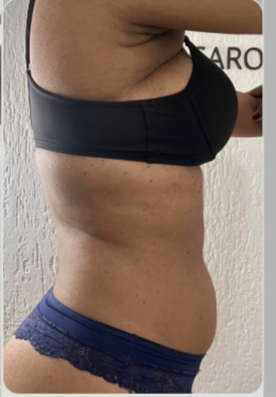 perfil depois do tratamento